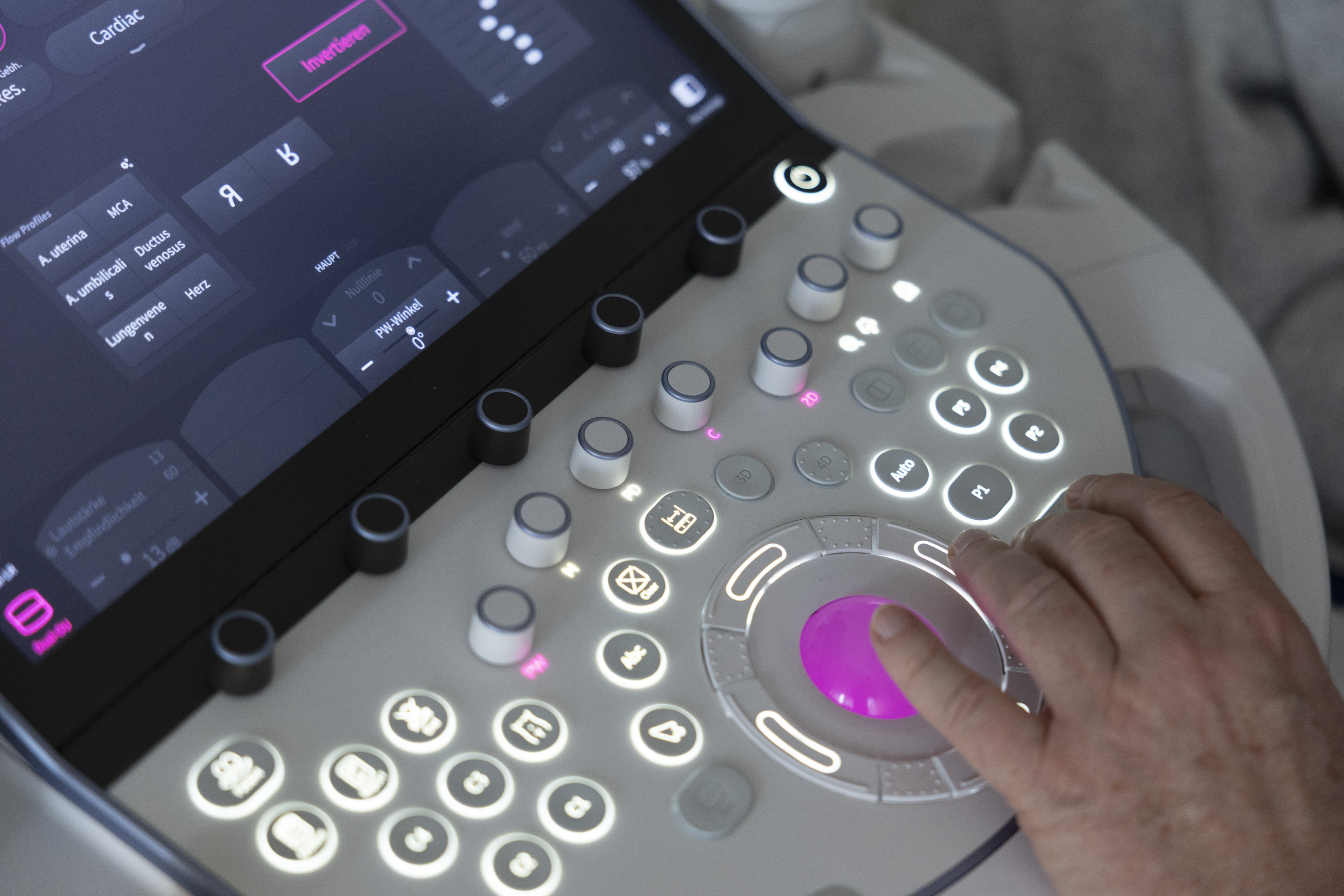 Ultraschalldiagnostik: Bedienfeld eines modernen Ultraschallgeräts für die Pränatalmedizin am Bürgerhospital Frankfurt.