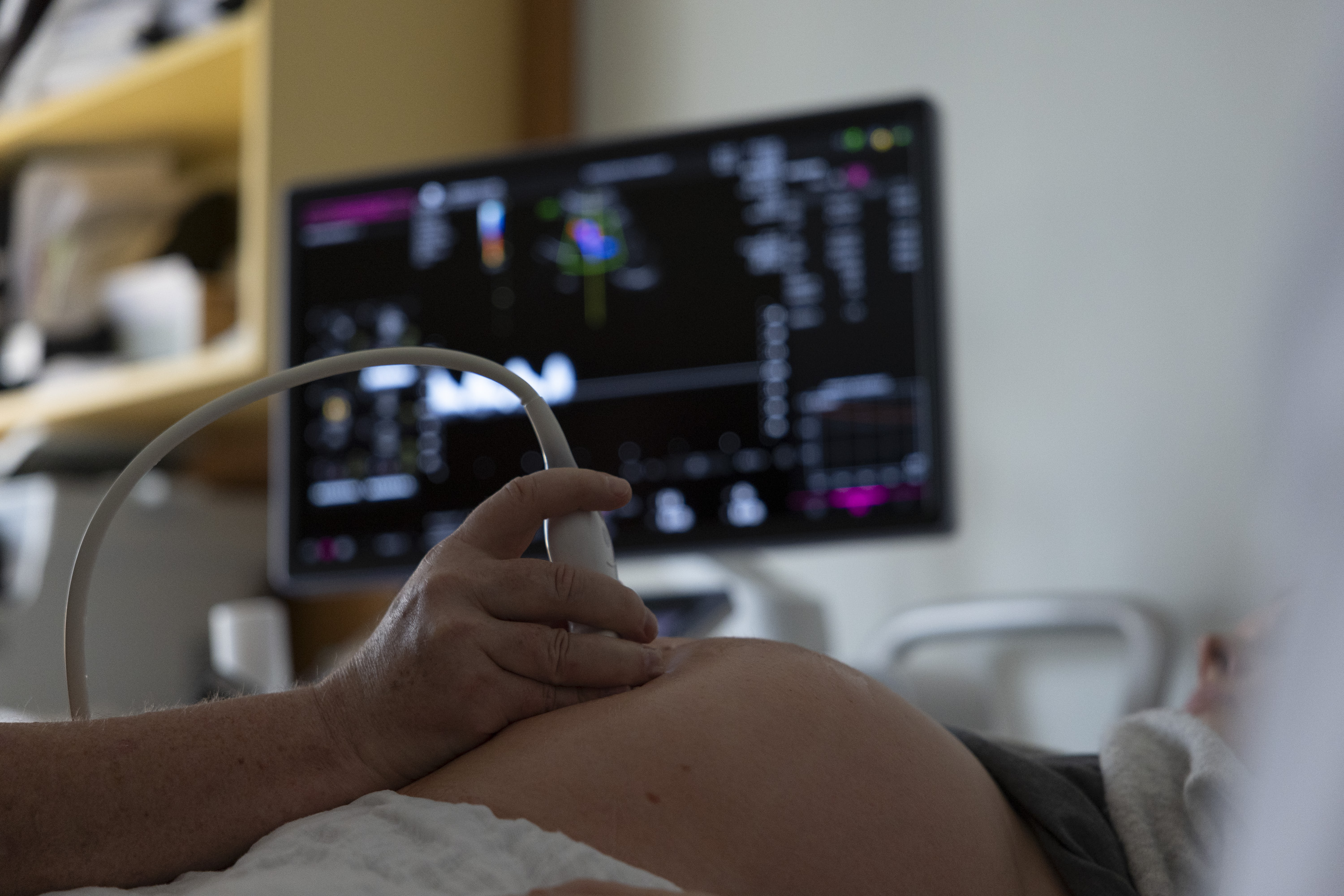 Ultraschalldiagnostik bei Schwangerenbauch zur pränatalen Untersuchung mit Ultraschallgerät im Bürgerhospital Frankfurt.