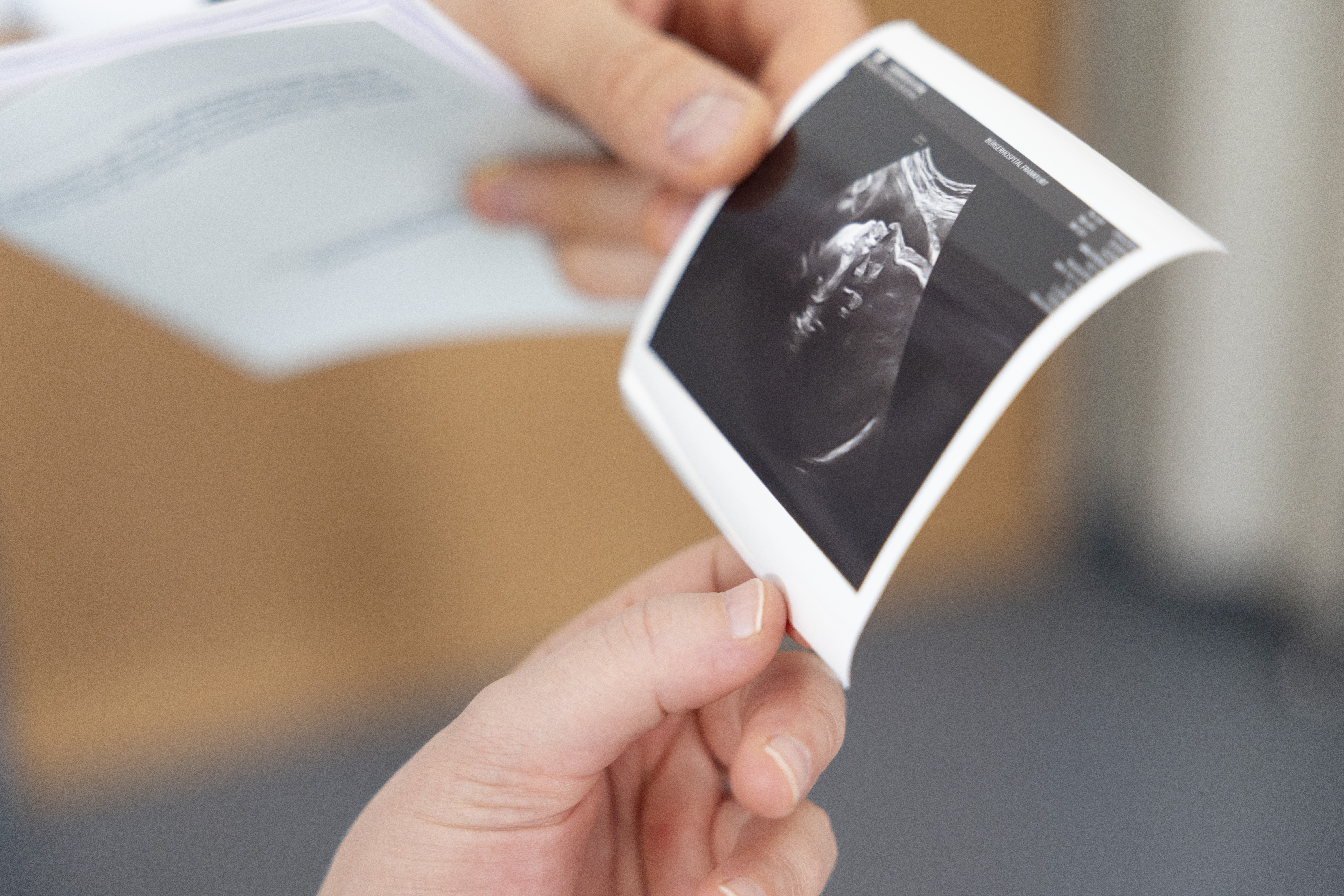 Geburtshilfe: Ultraschallbild eines Babys wird werdenden Eltern zur Erinnerung und für die Schwangerschaftsbetreuung übergeben.